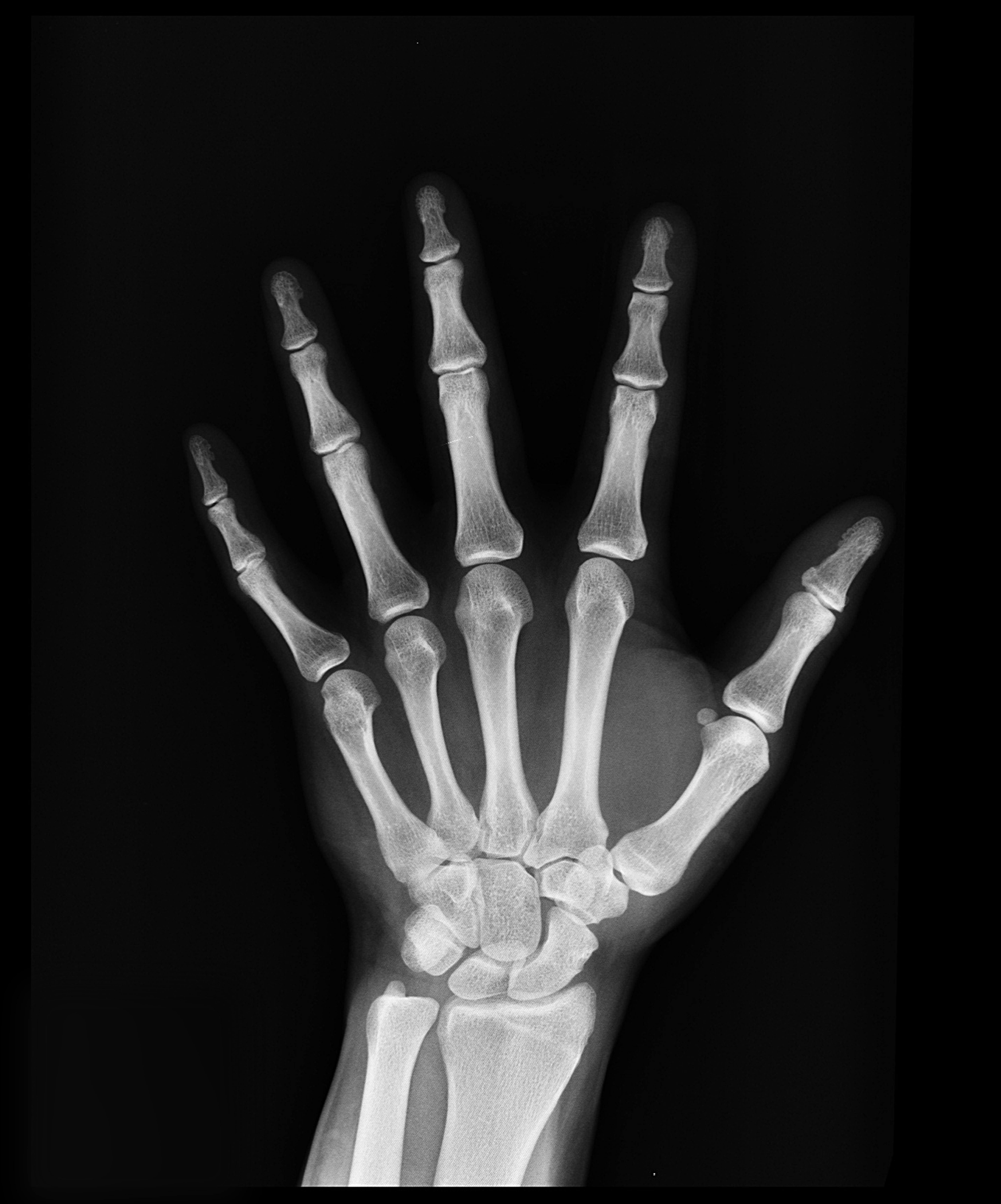 Tecniche di Radiologia Medica per Immagini e Radioterapia